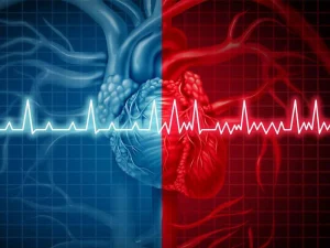 جراحی بای پس قلب چه زمانی انجام داده می شود؟