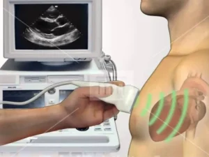 روش های اکو قلب