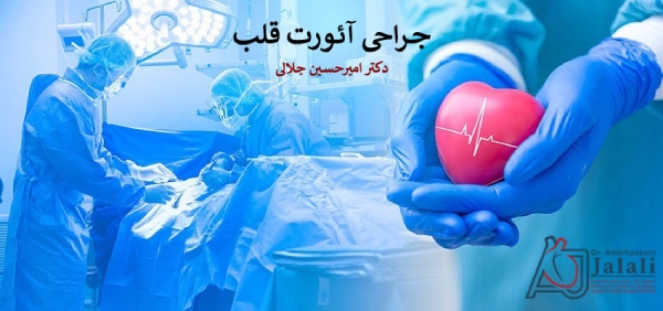 جراحی آئورت قلب