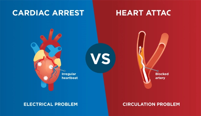 تفاوت ایست قلبی و حمله قلبی چیست؟
