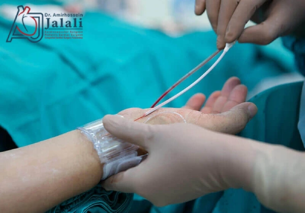 آنژیوگرافی قلب