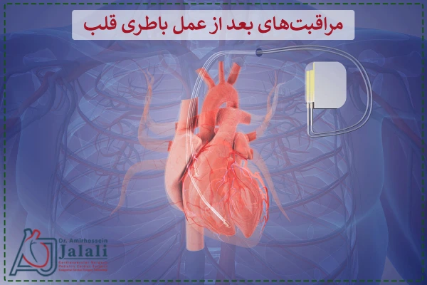 مراقبتهای بعد از عمل باطری قلب