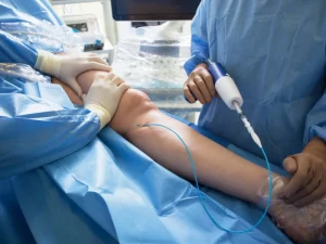 آنژیوگرافی قلب از طریق پا