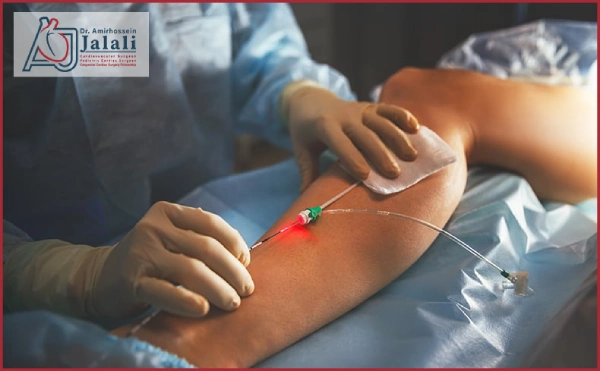 آنژیوگرافی قلب از طریق پا