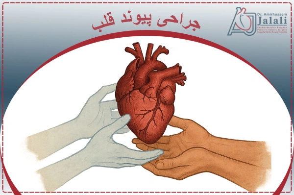جراحی پیوند قلب
