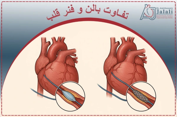 تفاوت بالن و فنر قلب