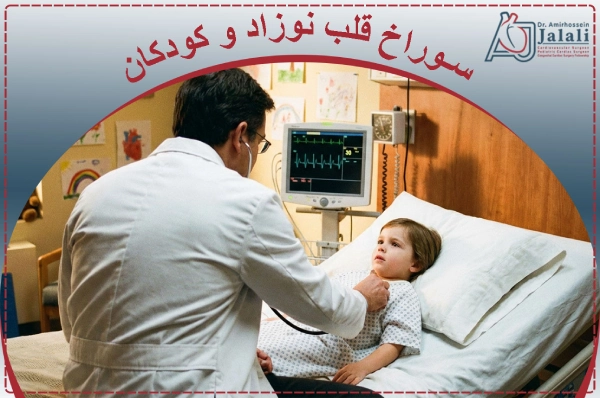 سوراخ قلب نوزاد و کودکان