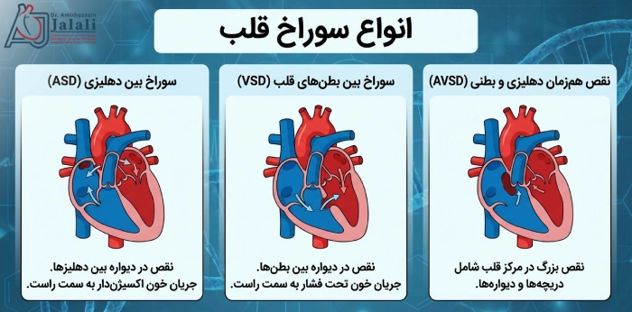 انواع سوراخ قلب